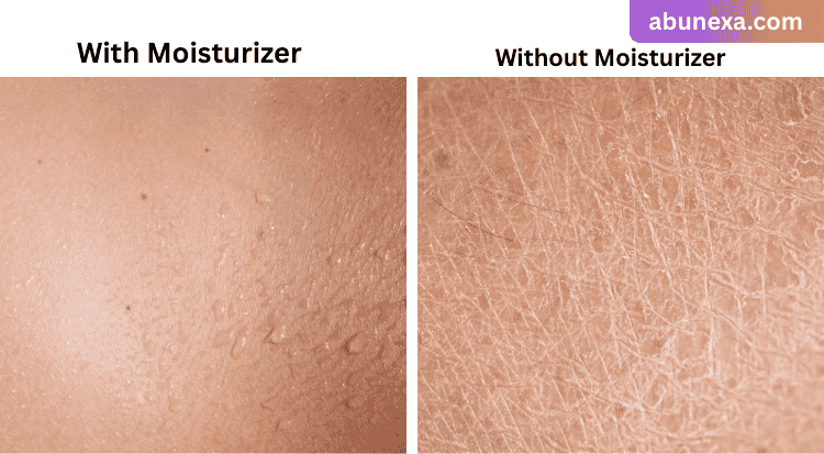 best moisturizer for dry skin face